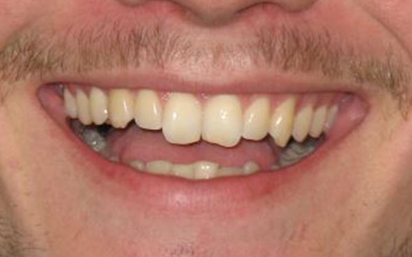 Before image