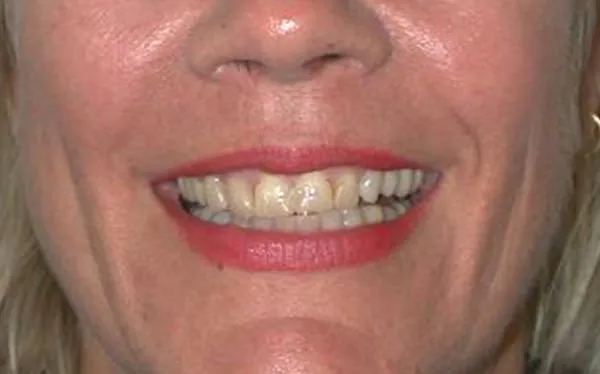 Before image