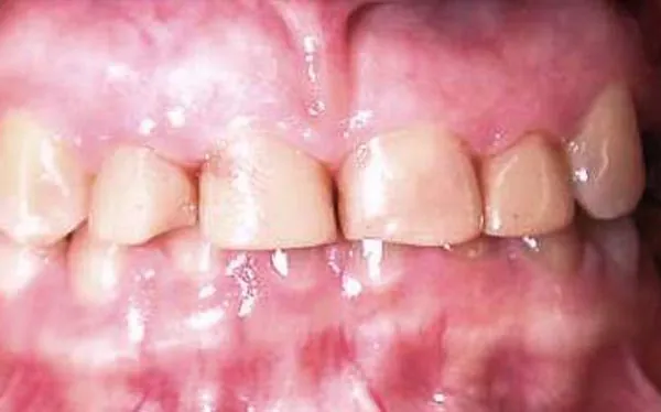 Before image