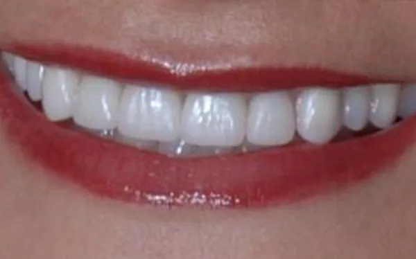 After image