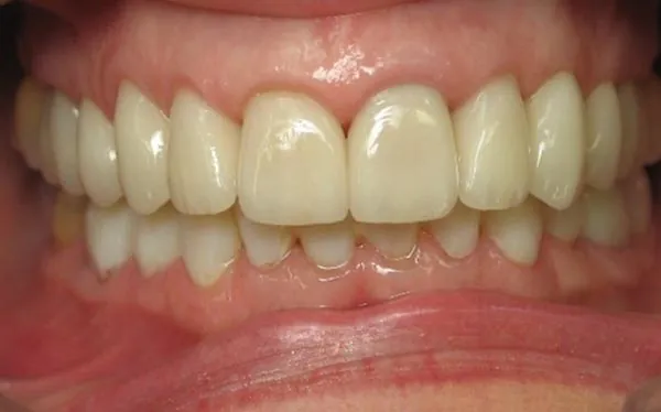 After image