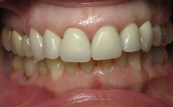 Before image