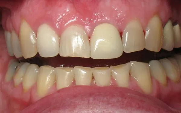 Before image