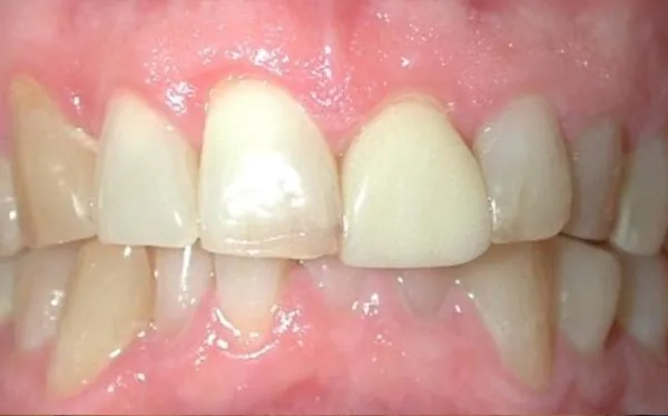 Before image